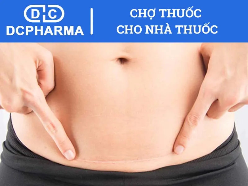 Sử dụng thuốc trị sẹo vết mổ sau sinh có tốt không?