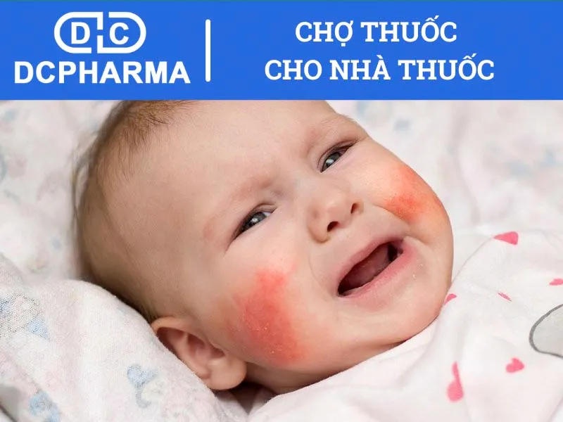 Thuốc Amoxicillin không được dùng trong trường hợp nào?