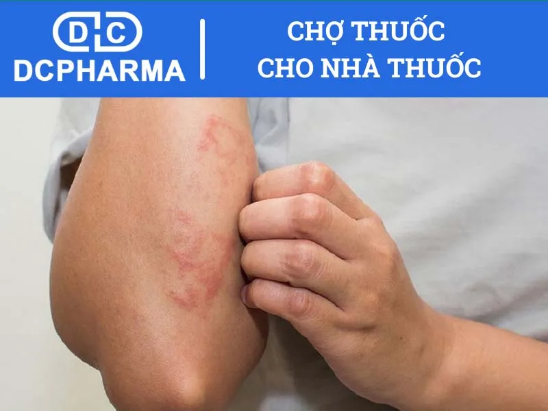 Thuốc bổ gan Arginin chống chỉ định trong trường hợp nào?