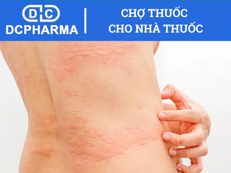 thuoc clorpheniramin 4 la thuoc gi cong dung cach dung va gia ban 67569c37bb2b2