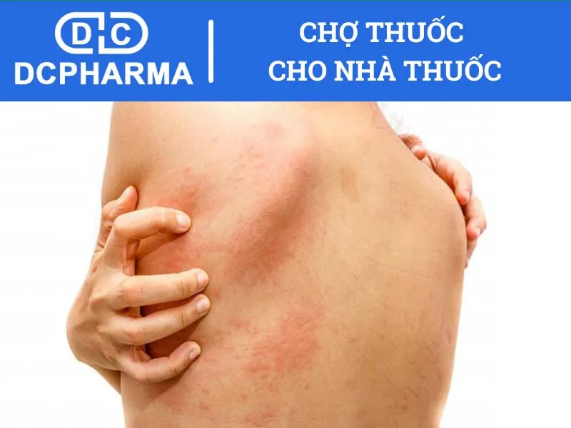 Thận trọng những gì khi sử dụng thuốc Dimedrol?