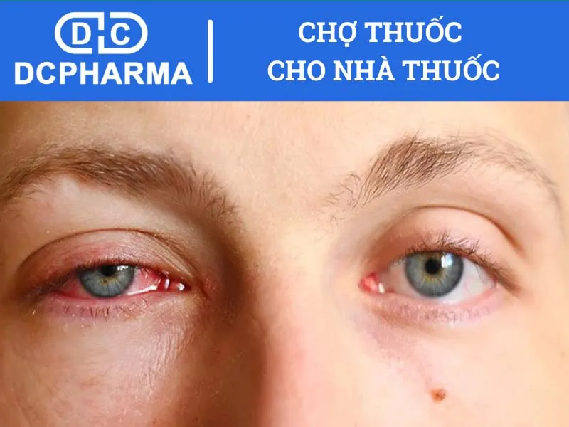 Tác dụng phụ của thuốc nhỏ mắt Eyemiru 40EX