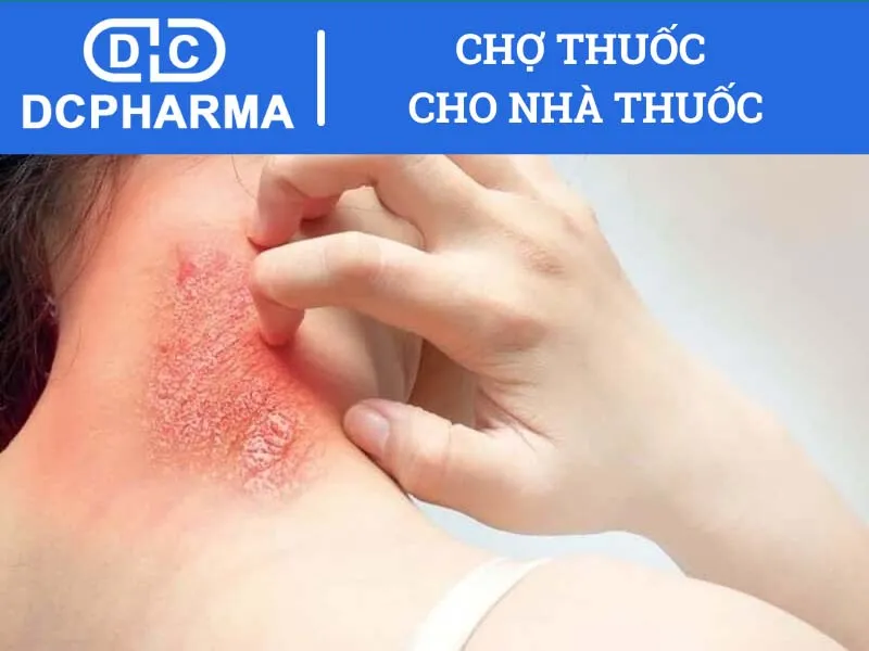 Thuốc Solumedrol là gì?